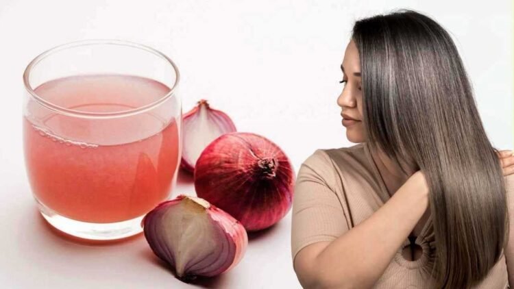 आपकी रसोई में छिपा है बालों का असली इलाज, प्याज के छिलकों से बनाएं नेचुरल शैंपू, होंगे काले-घने बाल