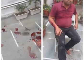 राजधानी रायपुर में फिर एक बार पिटबुल डाग का आंतक