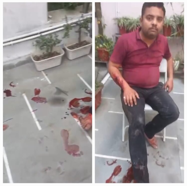 राजधानी रायपुर में फिर एक बार पिटबुल डाग का आंतक