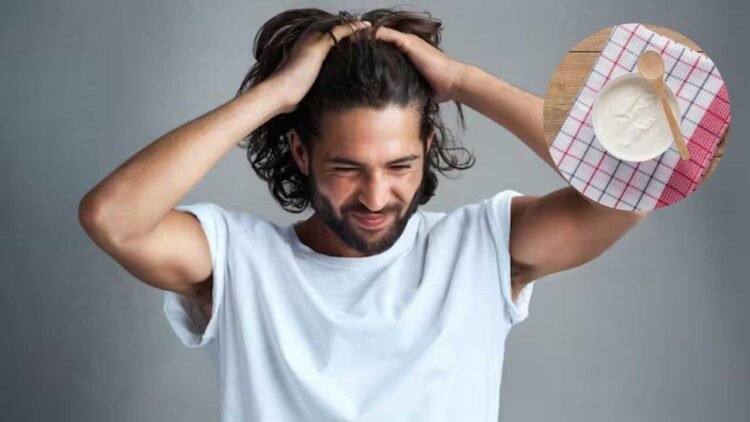 कहीं आप भी तो नहीं कर रहे डैंड्रफ को नजरअंदाज? दही में मिलाकर लगाएं ये 3 चीजें