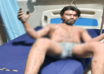 स्पंज आयरन प्लांट में हादसा, पिघला लोहा गिरने से 4 मजदूर झुलसे