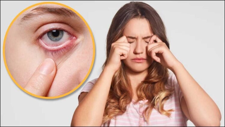 Eye Care Tips: जलन और चुभन से हैं परेशान? गर्मियों में आंखों को कूल रखने के लिए अपनाएं ये टिप्स